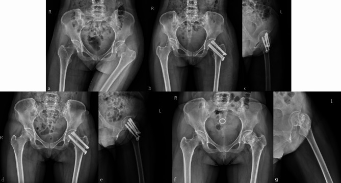Fig. 4
