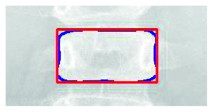 Figure 16