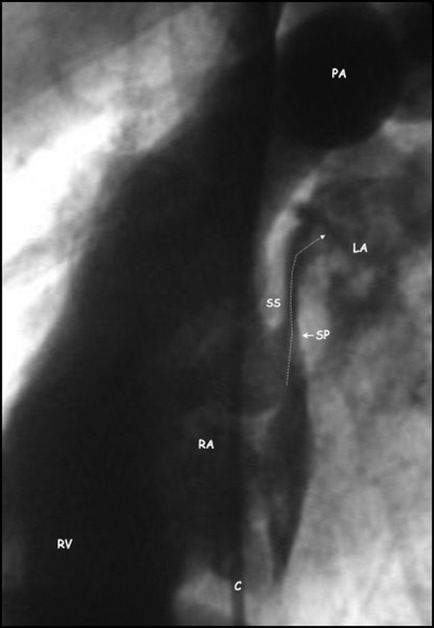 Figure 2