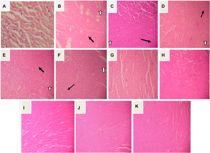 FIGURE12