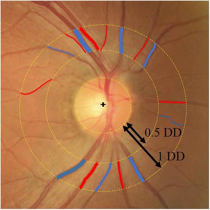 Fig 1