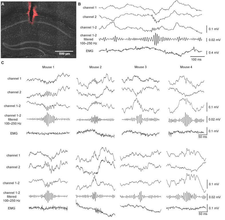 Figure 4—figure supplement 1.