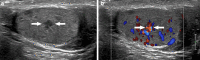 Fig. 17