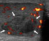 Fig. 12