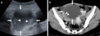 Fig. 28