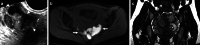 Fig. 34