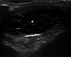 Fig. 19