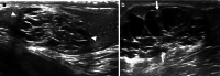 Fig. 20