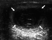 Fig. 11