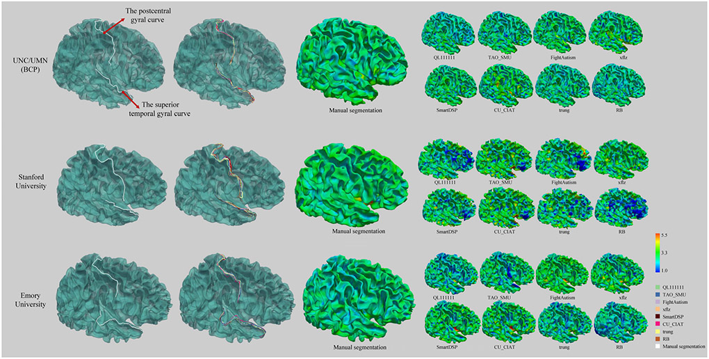 Fig. 14.