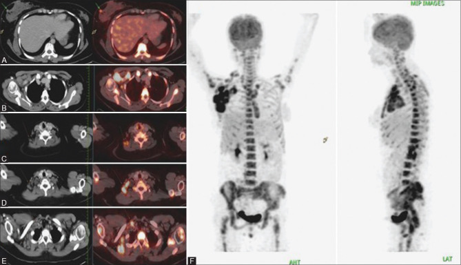 Figure 11(A-F)
