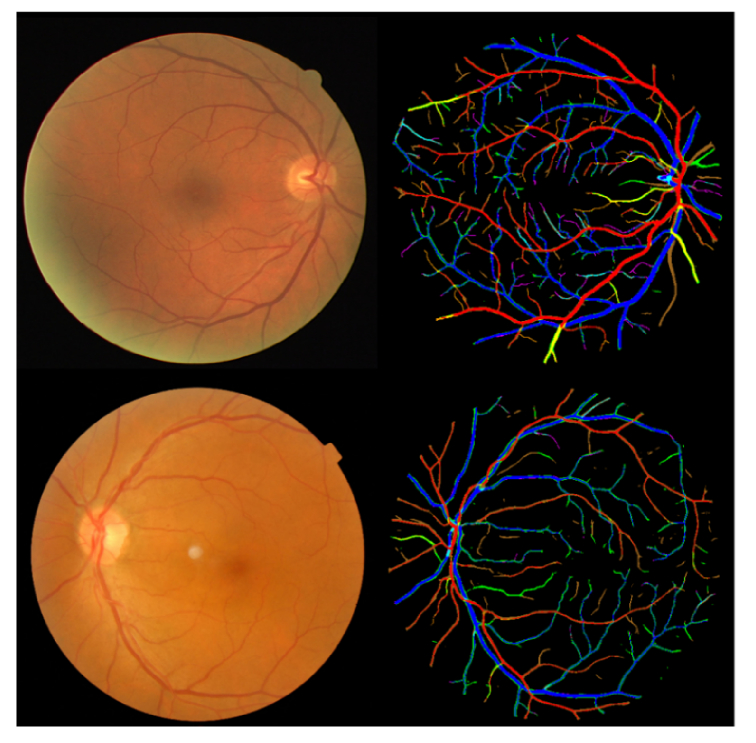 Fig. 11