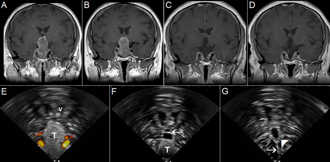 Figure 12