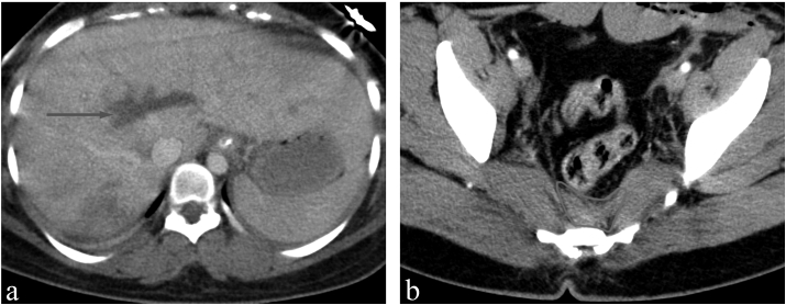 Fig. 4