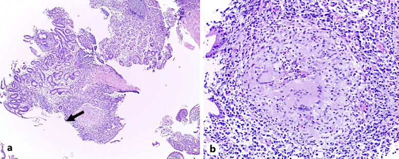 Fig. 3.