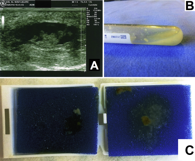 Fig. 2