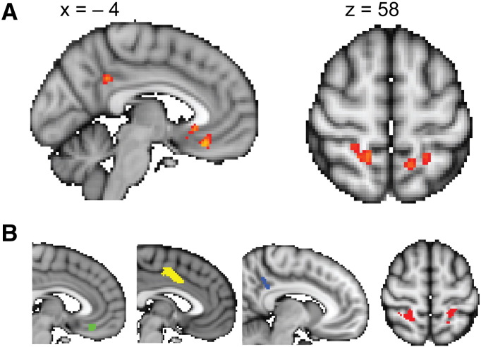 Fig. 4