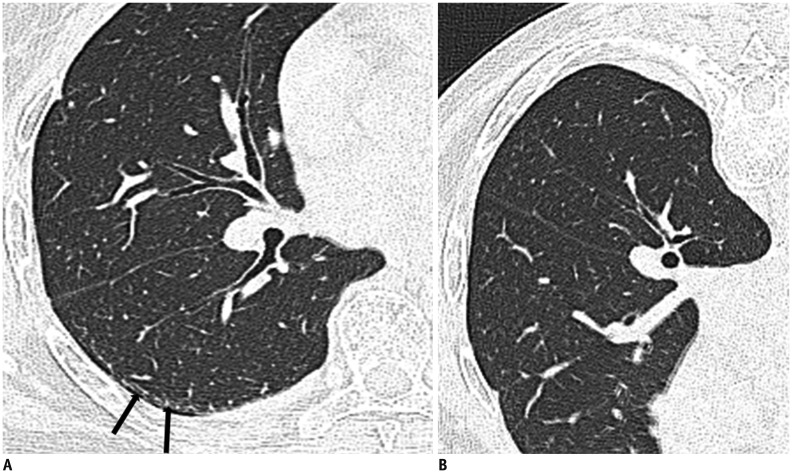 Fig. 11