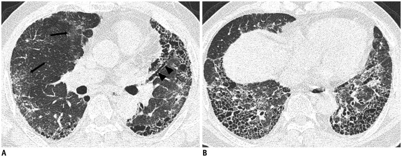 Fig. 10