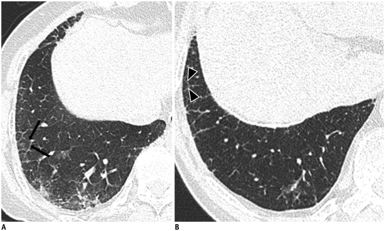 Fig. 9