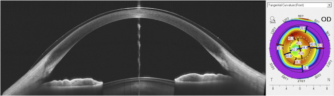 FIG. 2.