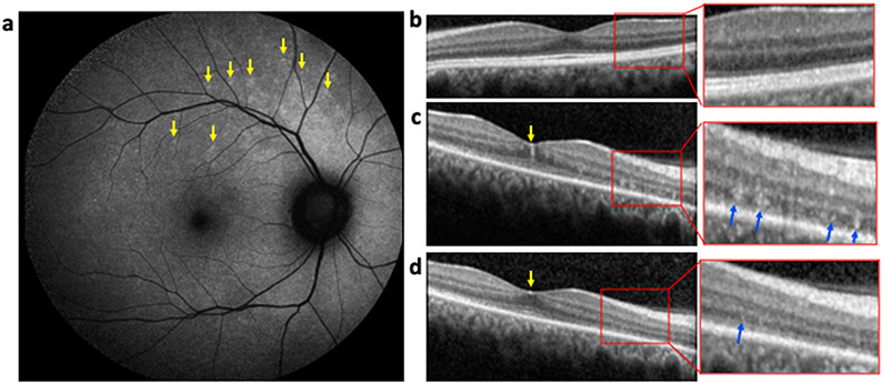 Figure 1: