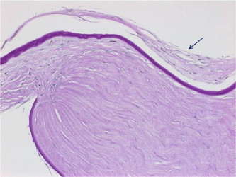 Figure 3b