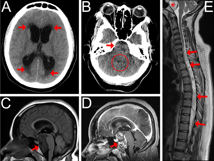 Fig 1