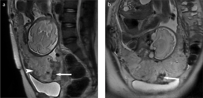 Figure 2. a, b