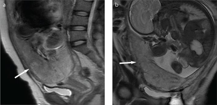 Figure 3. a, b