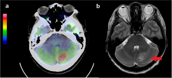 Fig. 3