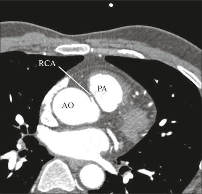 Figure 2)