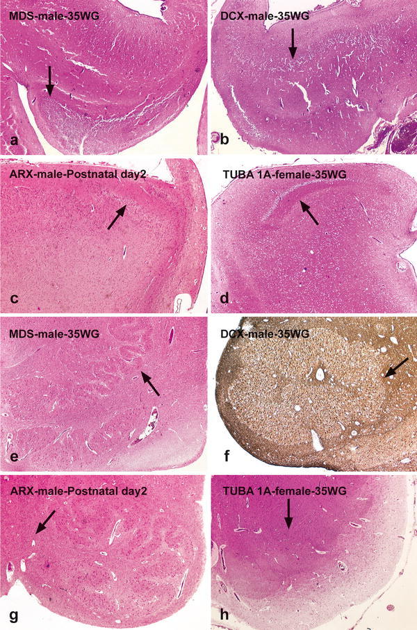 Fig. 4