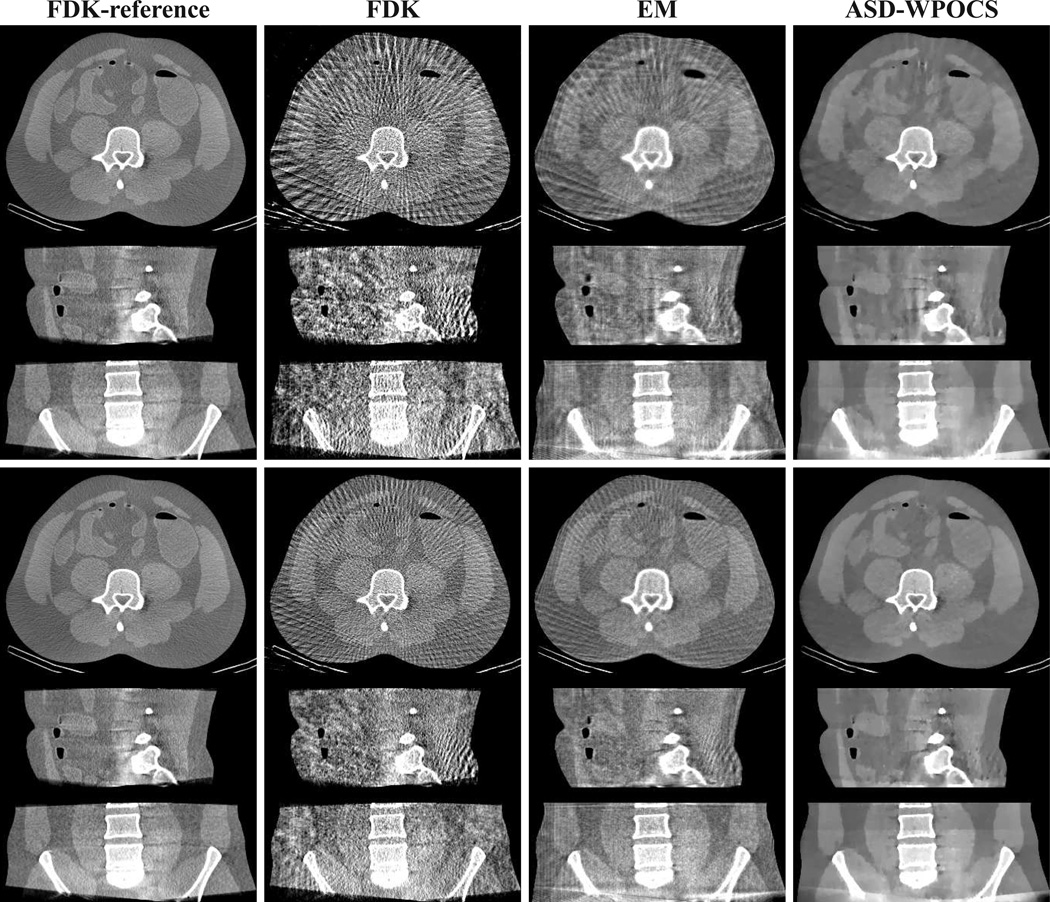 Figure 12