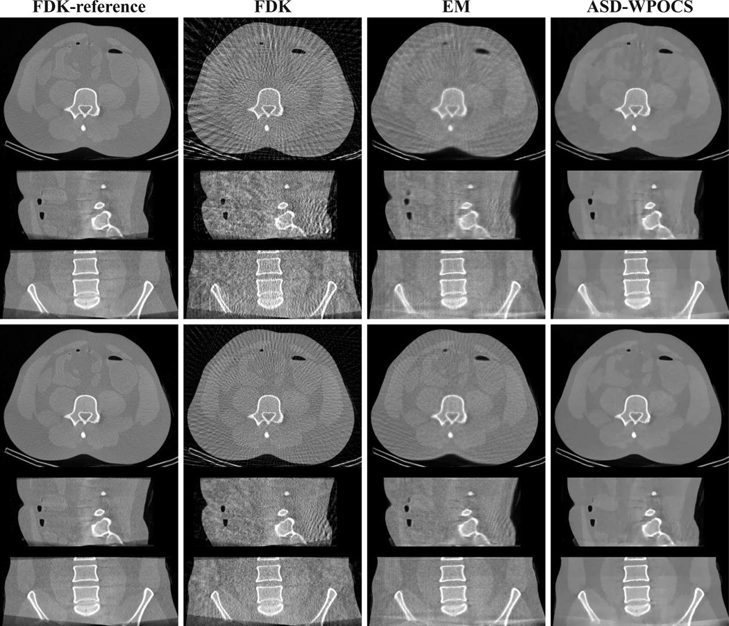 Figure 11