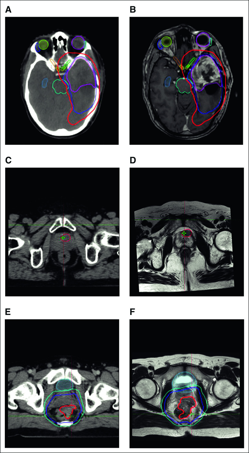 FIG 2