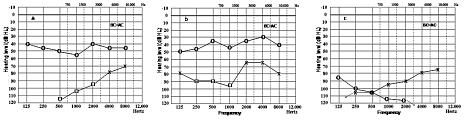 Fig. 1a-c.