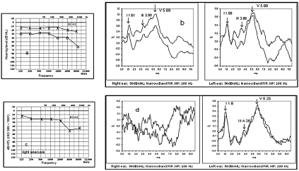 Fig. 3a-d.