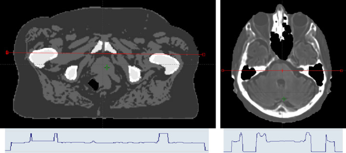 Fig. 1