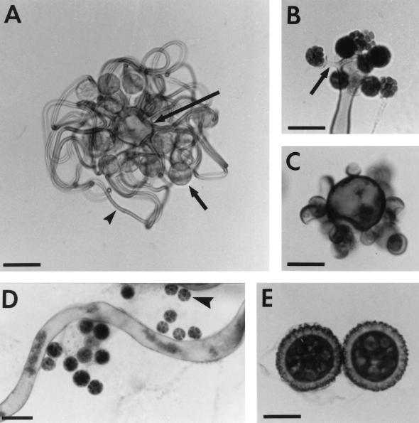 FIG. 17