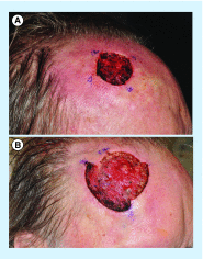 <b>Figure 4.</b>