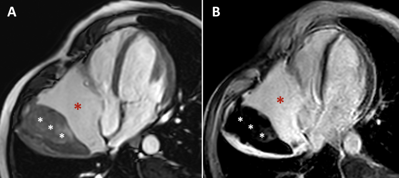 Figure 3