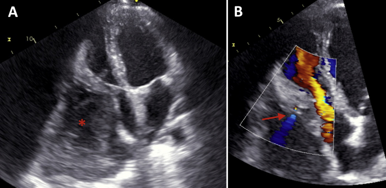 Figure 1