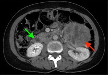 Fig. 1