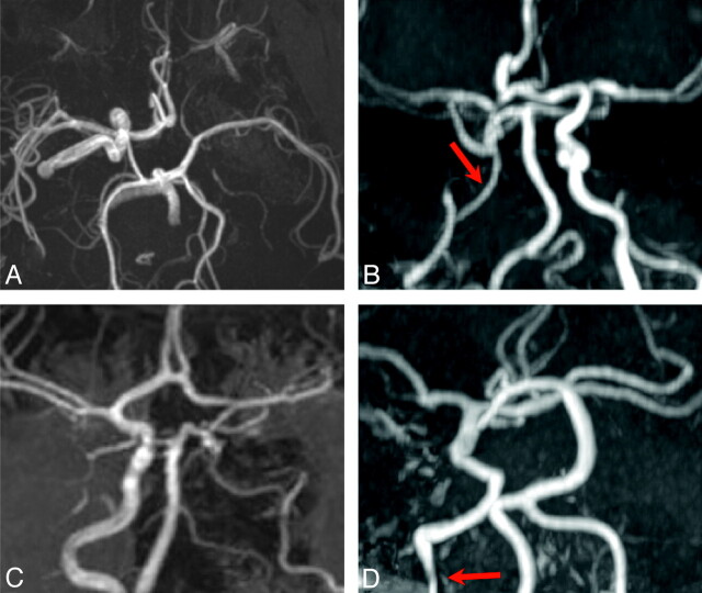 Fig 3.