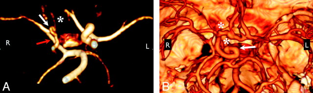 Fig 2.