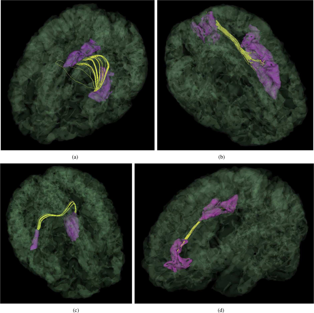 Fig. 10