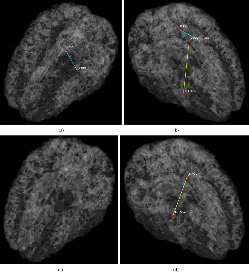 Fig. 11