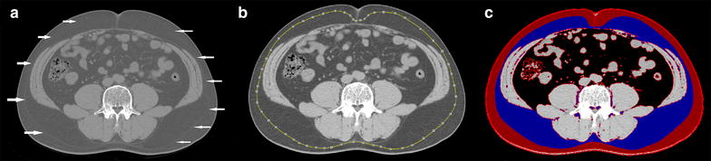 Fig. 1