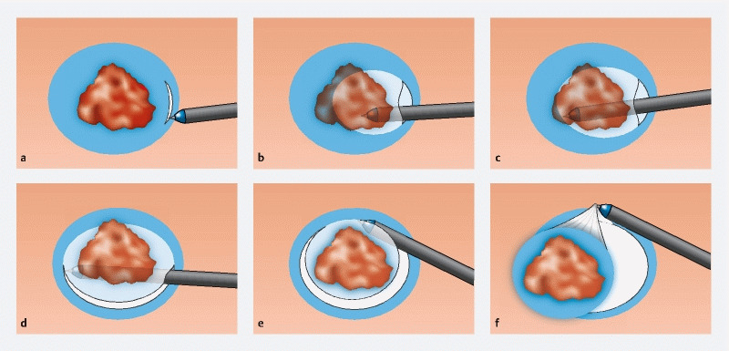 Fig. 1